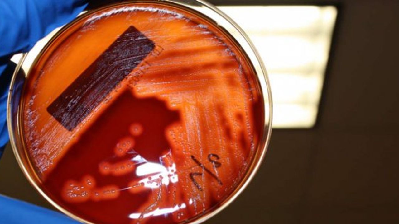 Şizofreni tanısında yeni bir kapı aralandı: Boğazdaki bakteriler