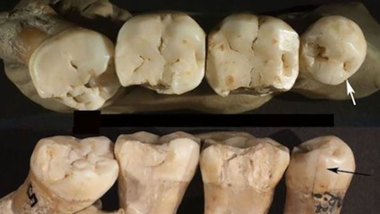 Neandertaller 130 bin yıl önce kürdan kullanıyordu