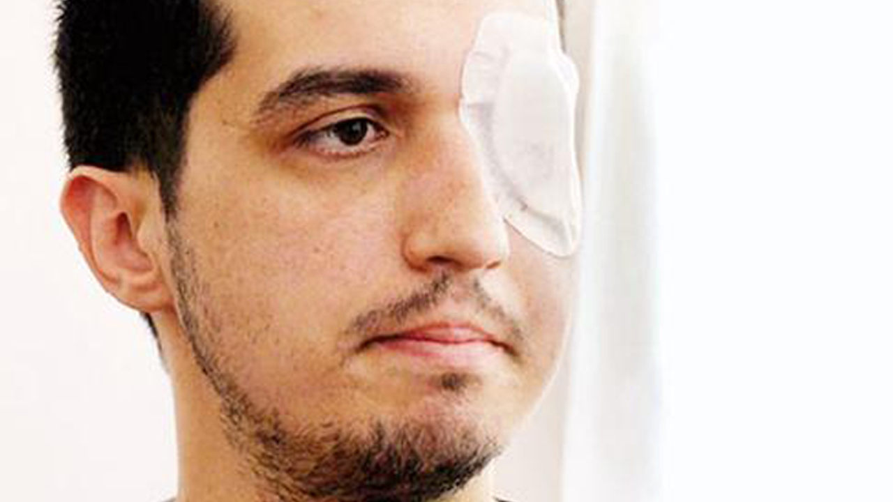 Gezi’de gözünü kaybeden akademisyene bakanlıktan 1 milyon lira tazminat