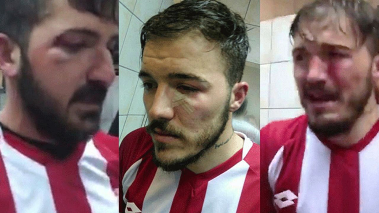 Maç sonrası futbolculara saldırı