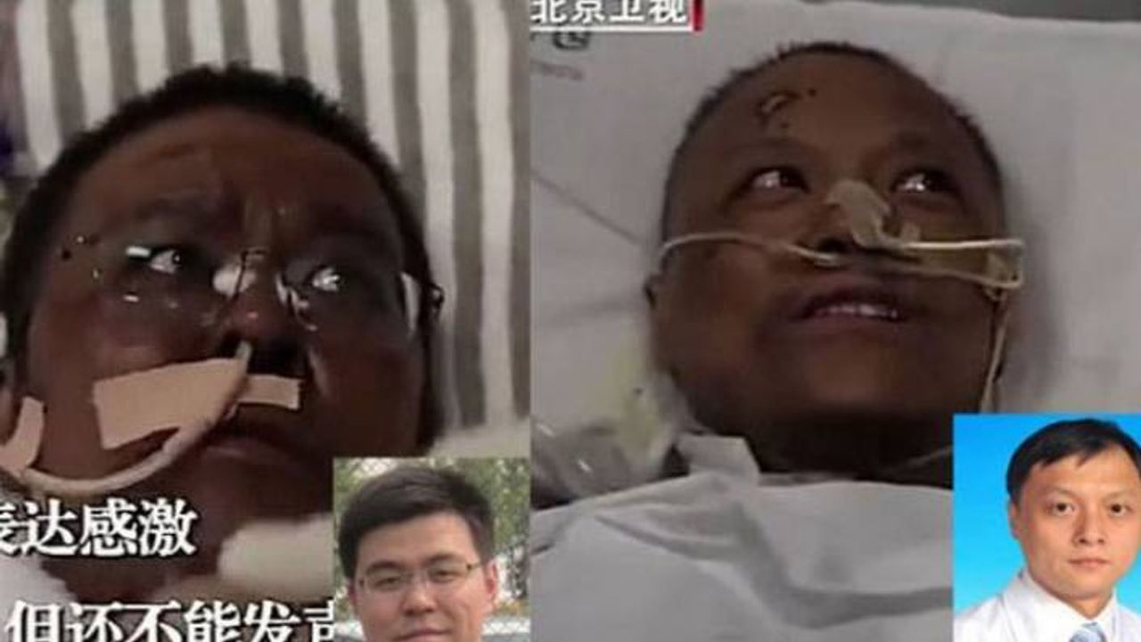 Korona tedavisi gören iki Wuhanlı doktorun ten rengi değişti