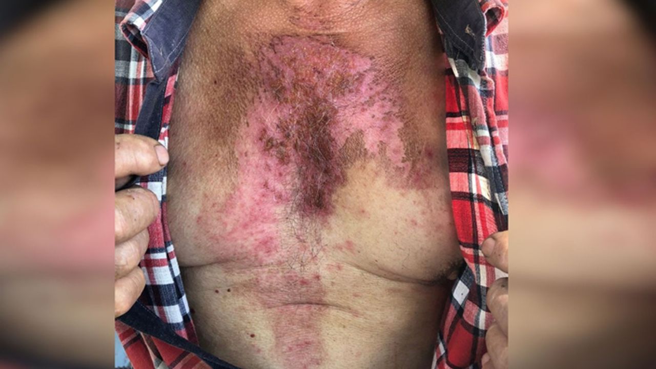 Gazeteci Melis Alphan, Çapaklı köylülerinin jandarma tarafından uğradığı şiddetin fotoğrafını paylaştı