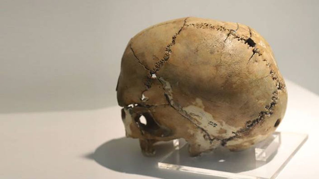 Aşıklı Höyük'te 9 bin 500 yıllık, beyin ameliyatlı kafatası bulunan kadın 'canlandırılacak'