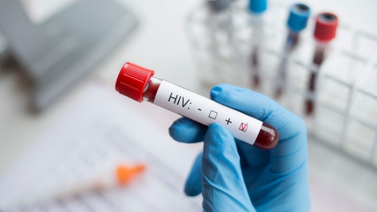 HIV’in daha hızlı yayılabilen varyantı çıktı