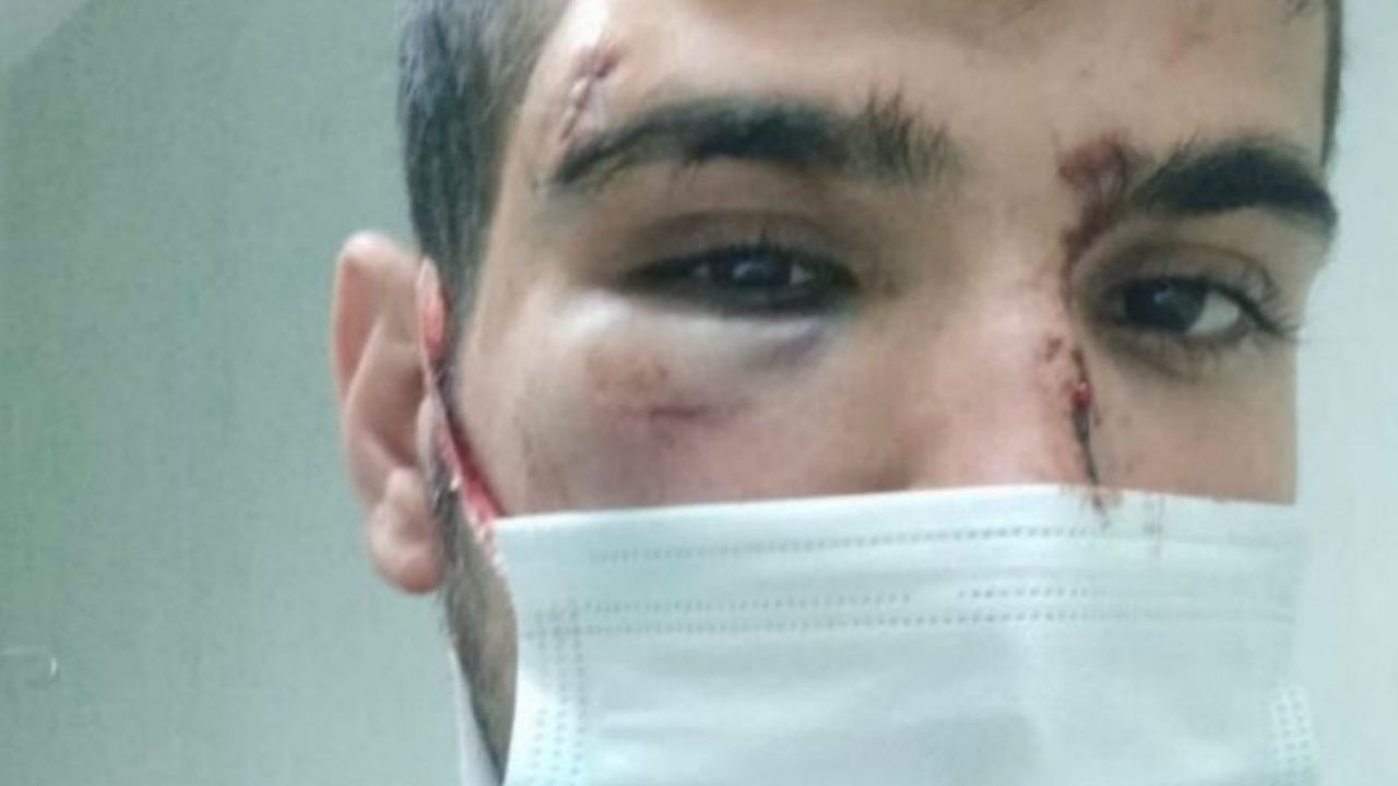 Akdeniz Üniversitesi'nde Kürt öğrencilere saldırı