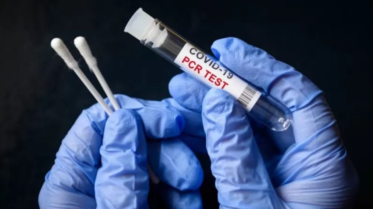Koronavirüs: 17 kişi daha hayatını kaybetti, 3 bin 354 yeni vaka tespit edildi