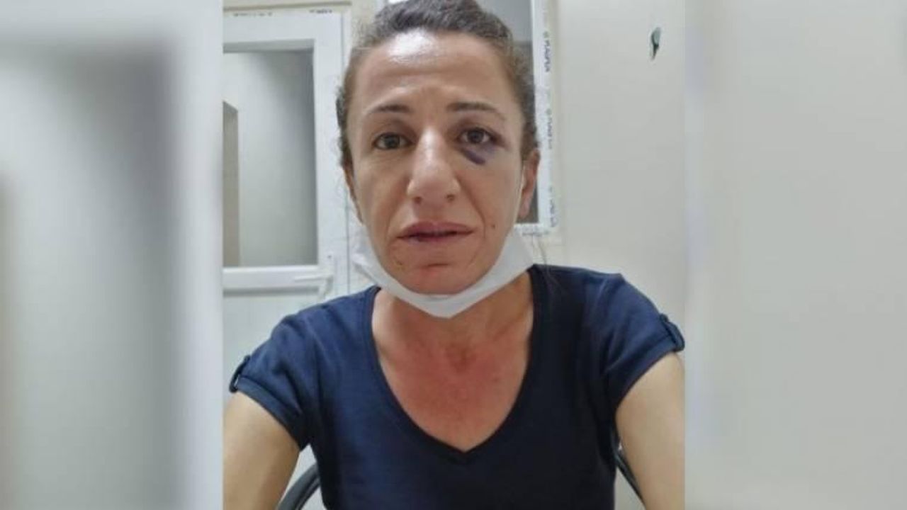 HDP'li Rojbin Çetin’e, köpekle işkence eden polis hakkında ‘basit yaralama’dan dava