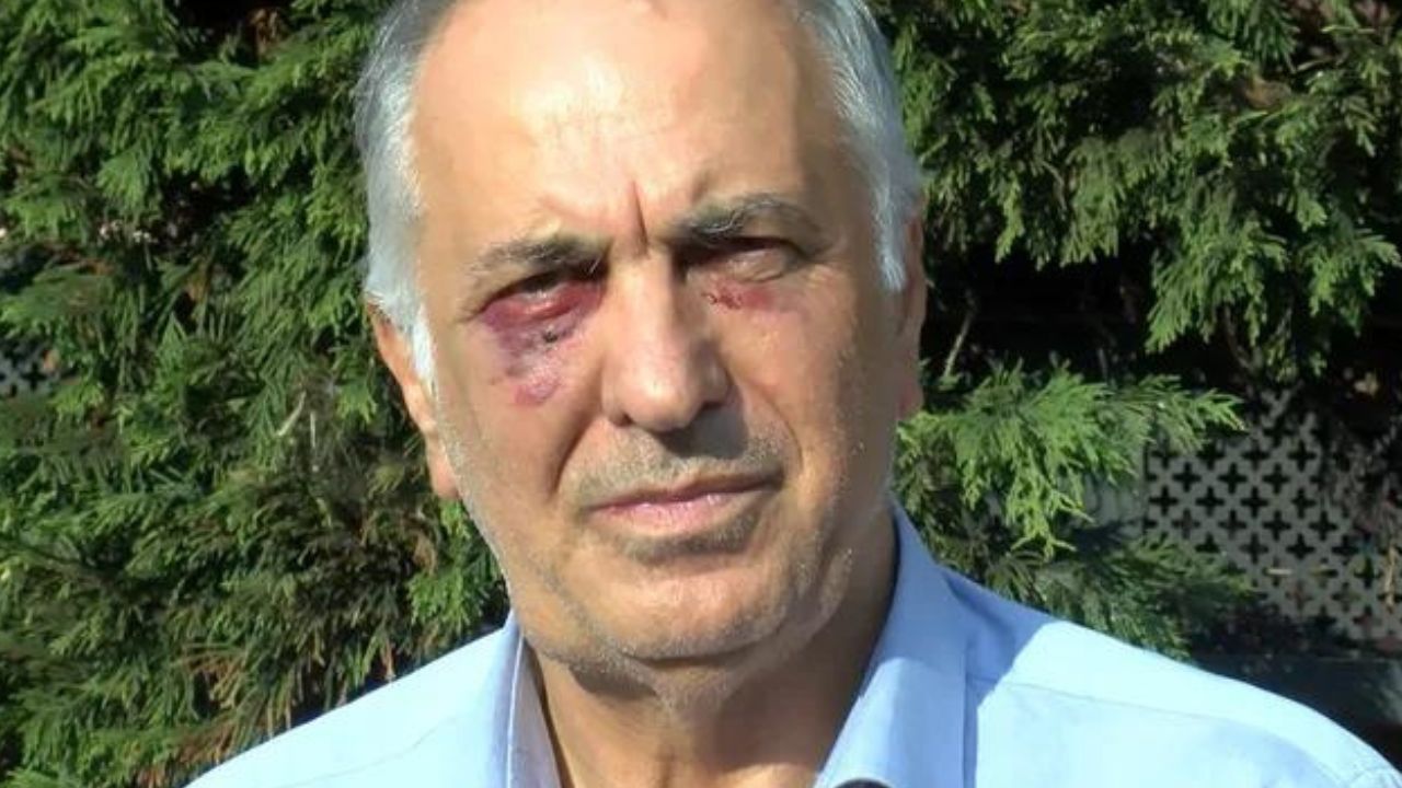 Kartal Cemevi Başkanı Selami Sarıtaş uğradığı saldırıyı anlattı