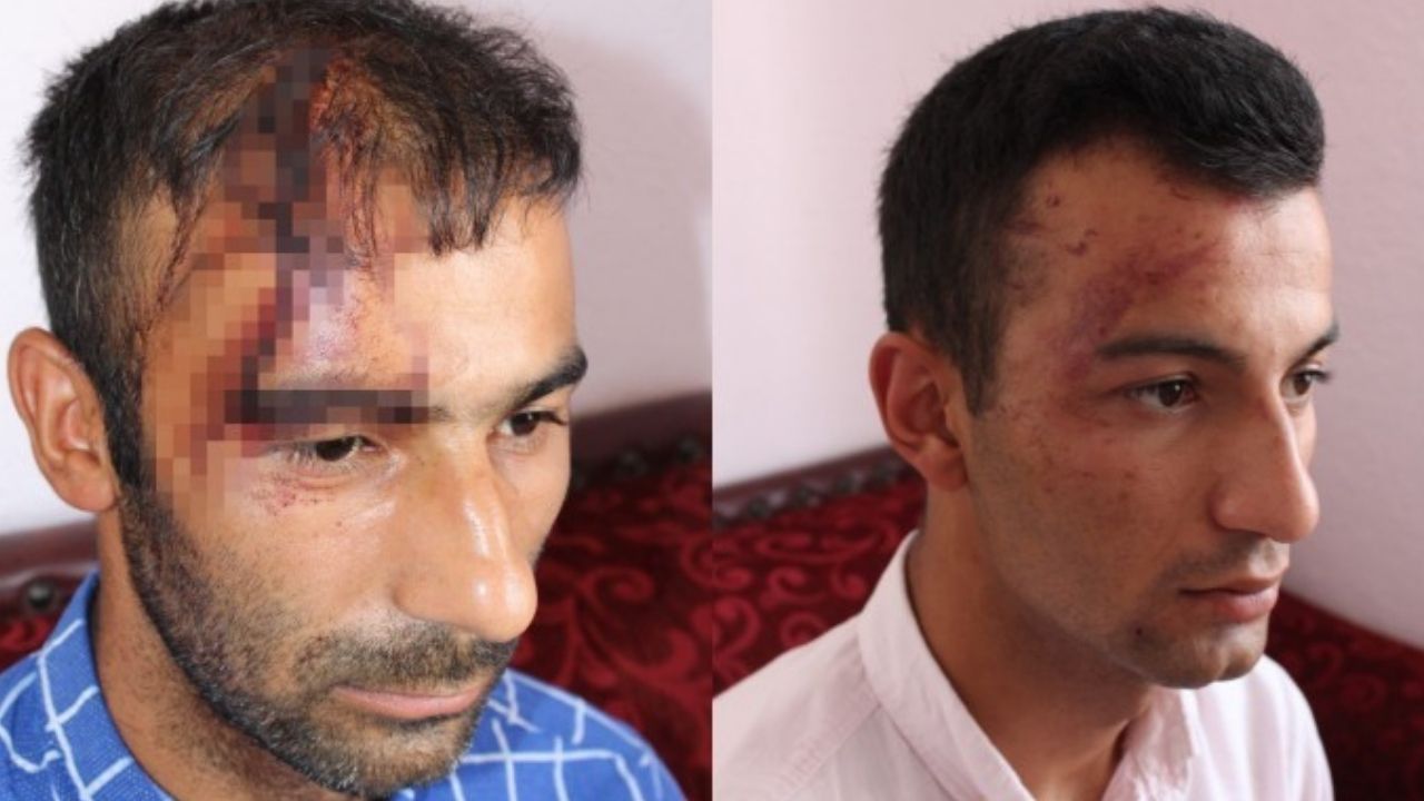 Aydın’da Kürt aileye ırkçı saldırı: Silah sıkıldı