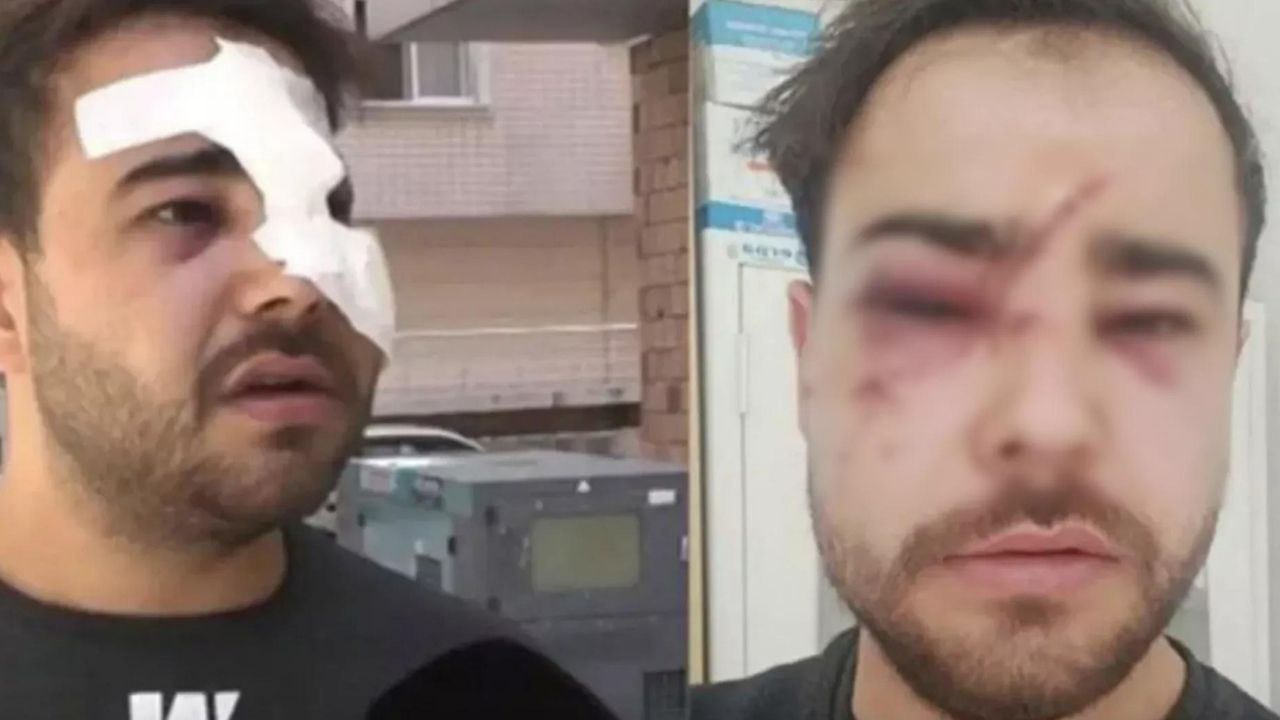 Onur Şener cinayeti hala gündemdeyken: Sokak müzisyeninin yüzünde şişe kırdılar