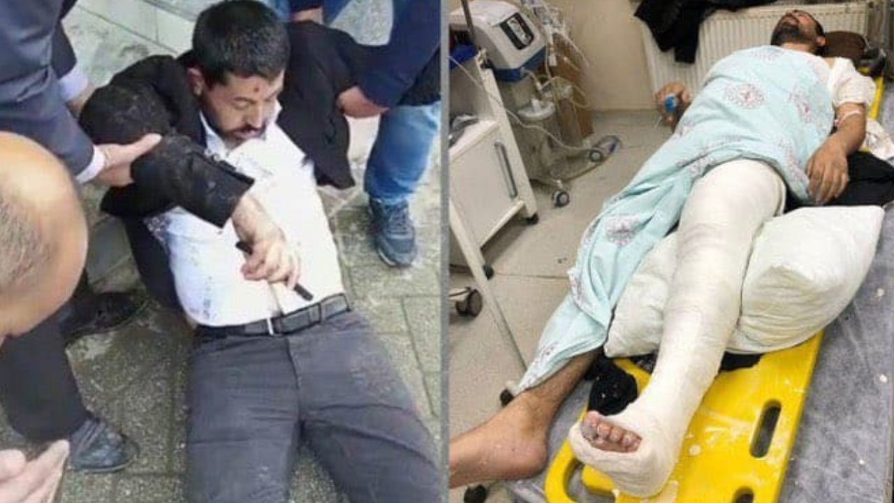 Polis saldırmıştı: Soylu'ya göre HDP’li vekilin ayağını 'HDP’liler kırdı'