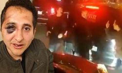Avukat Sürenoğlu’nu döven Cumhurbaşkanı korumalarına takipsizlik