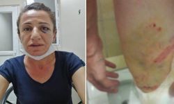 Gözaltında işkenceyi belgeleyen avukat ifadeye çağrıldı