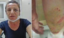 ‘Çetin’e yönelik işkence insanlık onuruna yapıldı’