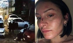 Polis şiddettine uğrayan Gökçe Yaşar: Bütün düzenim bozuldu, evime de gidemiyorum