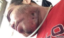 Biber gazı yüzünden kanser olan İstif savcılığa başvurdu