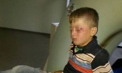 Cizre'de polis saldırısı: 8 yaşındaki çocuk gözünden vuruldu