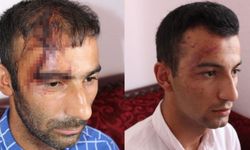 Aydın’da Kürt aileye ırkçı saldırı: Silah sıkıldı