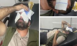 HDP İl yöneticisi Yakup Orak'a polis şiddeti
