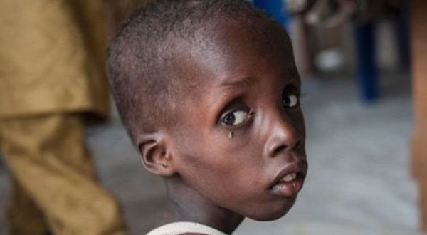 UNICEF: Nijerya'da çocuklar kıtlık tehlikesinde