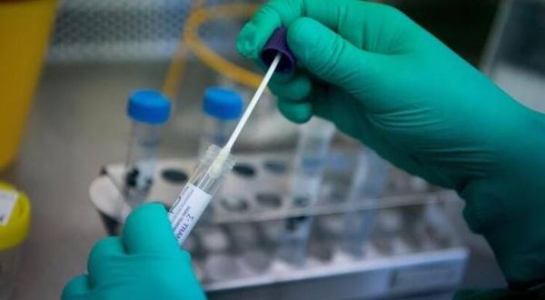 SGK, PCR testi negatif çıkanları da 'pandemi hastası' kabul etti