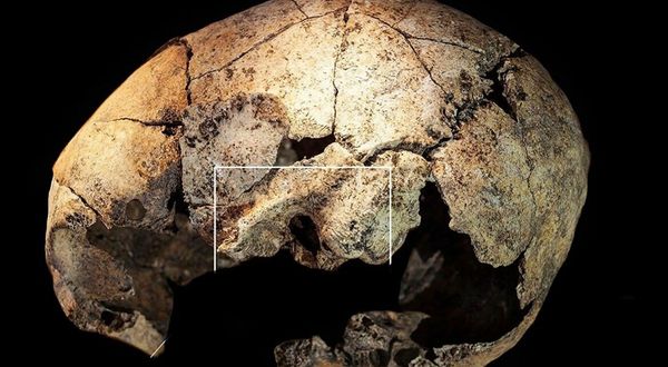 5300 yıllık kafatasında bilinen en eski kulak ameliyatına dair izler keşfedildi