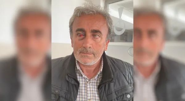 Gözaltında işkence gördüğü öne sürülen Karabaş yeniden gözaltına alındı