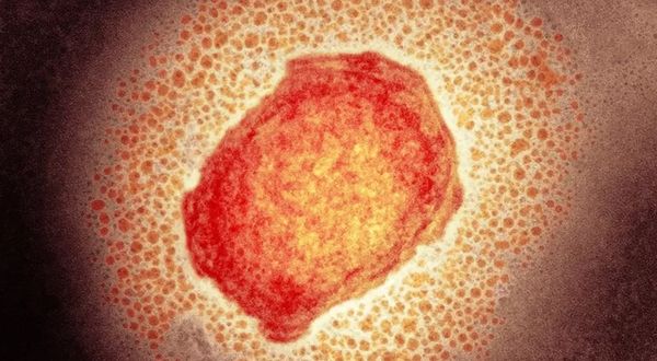 ABD'de maymun çiçeği virüsü yüzünden yeni uyarı