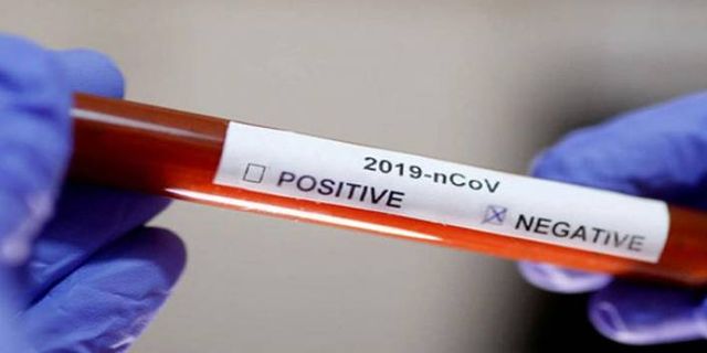 Koronavirüsten ölen bazı hastaların test sonucu nasıl negatif çıkıyor?