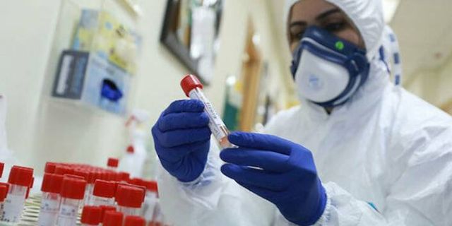 Sağlık Bakanlığı koronavirüs testi kriterlerini değiştiriyor