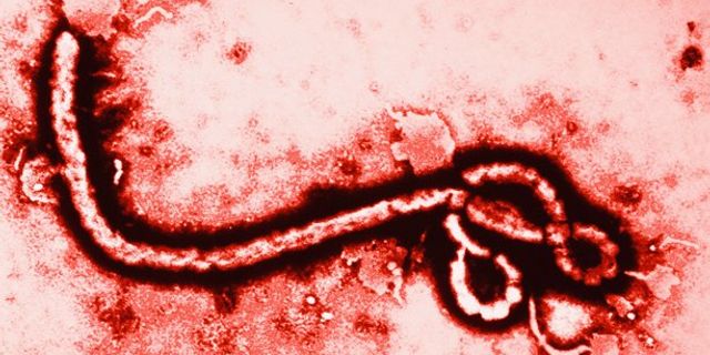 Ebola’da son üç günde bin 250’yi aşkın ölüm!