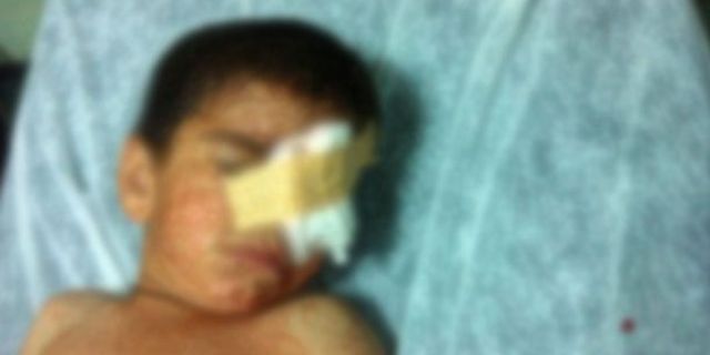 Gaz kapsülü isabet eden evde 6 yaşındaki çocuk başından yaralandı!
