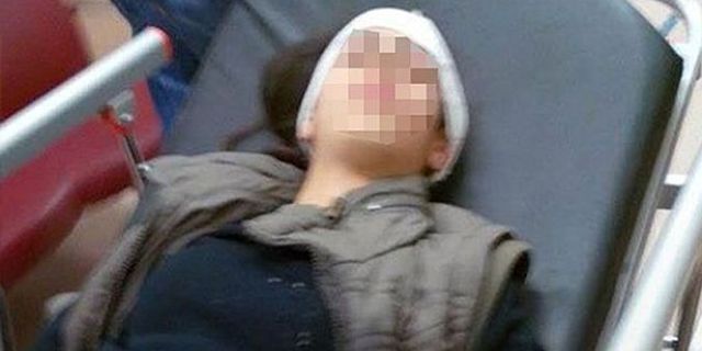 Gazi Mahallesi'nde 14 yaşındaki kız çocuğu polisin gaz kapsülüyle ağır yaralandı