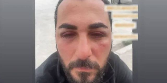 Depremzedelere bekçi şiddeti iddiası: Burada OHAL var, devlet de yargı da biziz