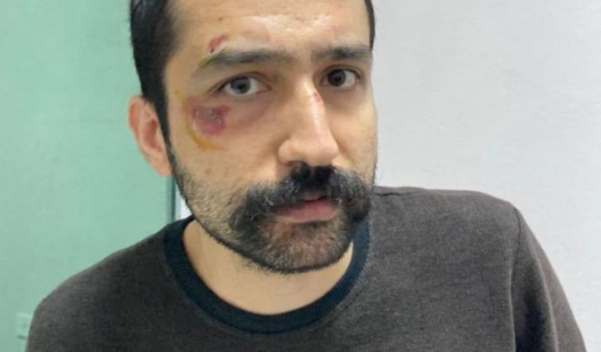 Avukat Aytaç Ünsal’a gözaltında işkence