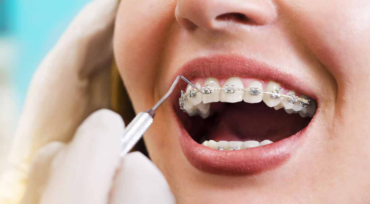 ortodontik-tedavi