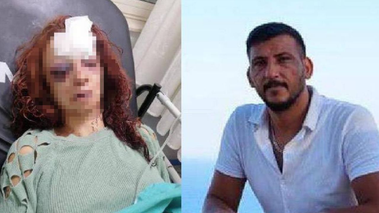 Erkek şiddeti: Hasan Sevinçer’in öldüresiye dövdüğü Rahime, 4 gündür yoğun bakımda